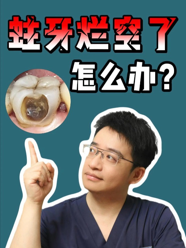 蛀牙烂空了怎么办?