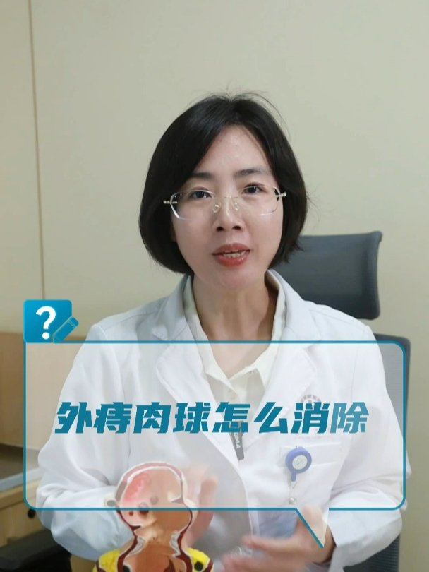 外痔肉球怎么消除?