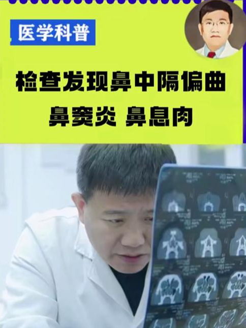 检查发现鼻中隔偏曲 鼻窦炎 鼻息肉