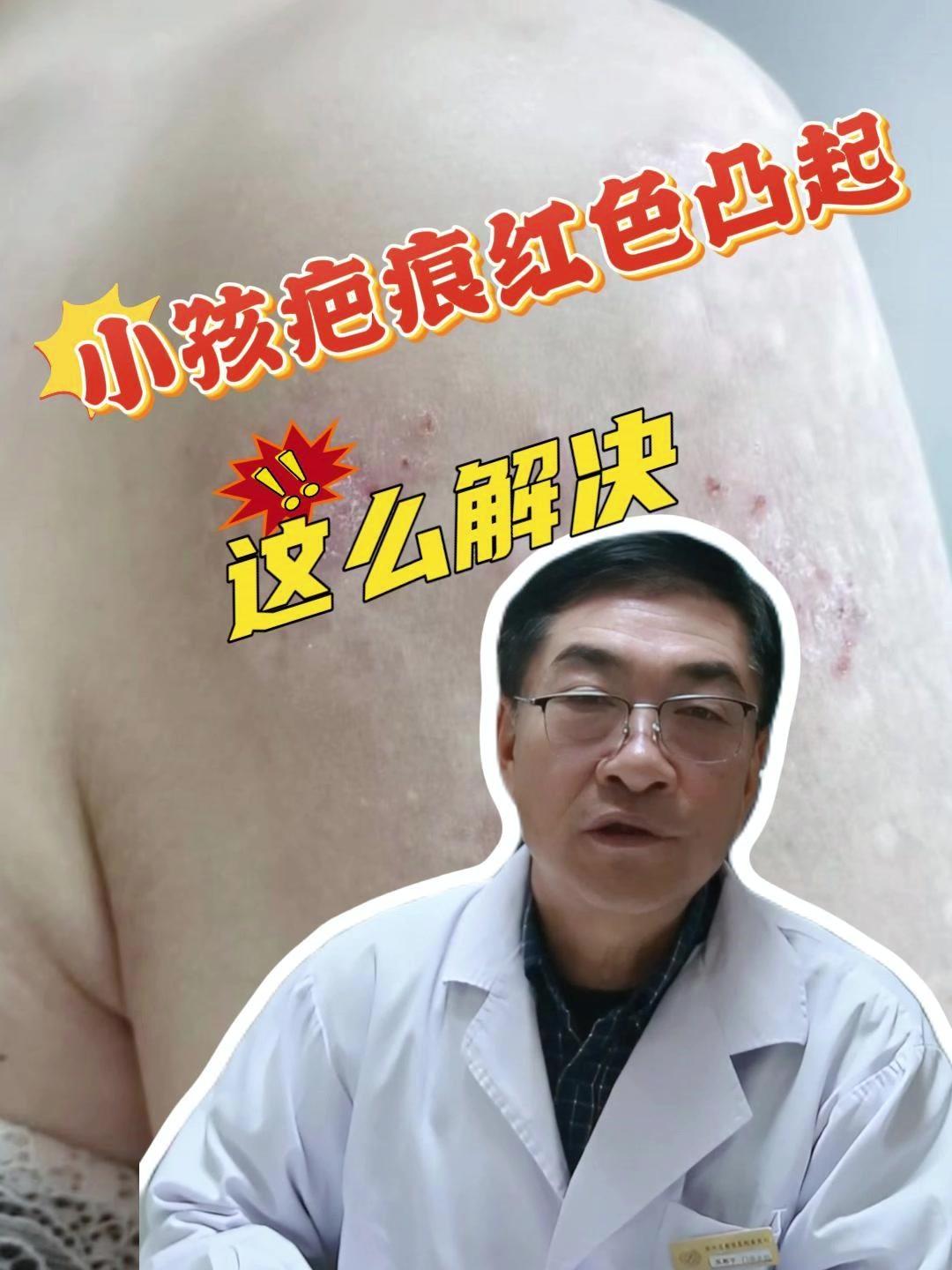 小孩疤痕红色凸起,这么解决!
