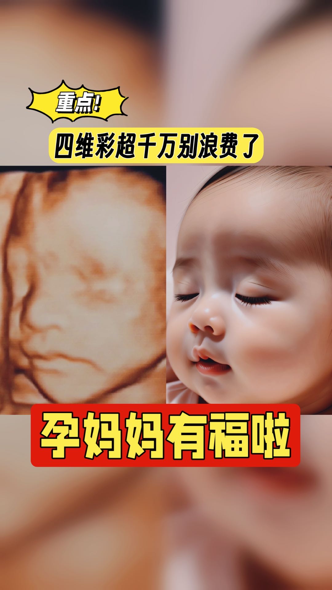 拍过四维彩超的孕妈妈有福啦!让你提前看到未来宝宝的样子!