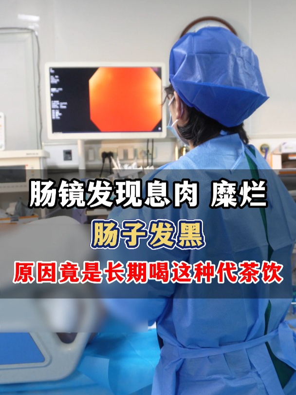 肠镜发现息肉 糜烂 肠子发黑,原因竟是长期喝这种代茶饮