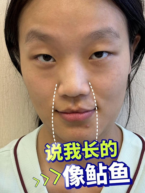 居然说我长得像鲇鱼!哭死