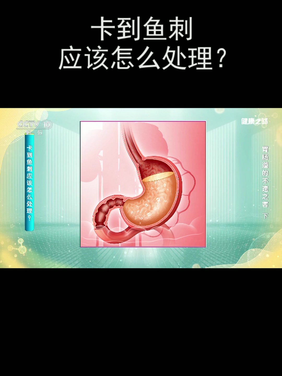 卡到鱼刺应该怎么处理?