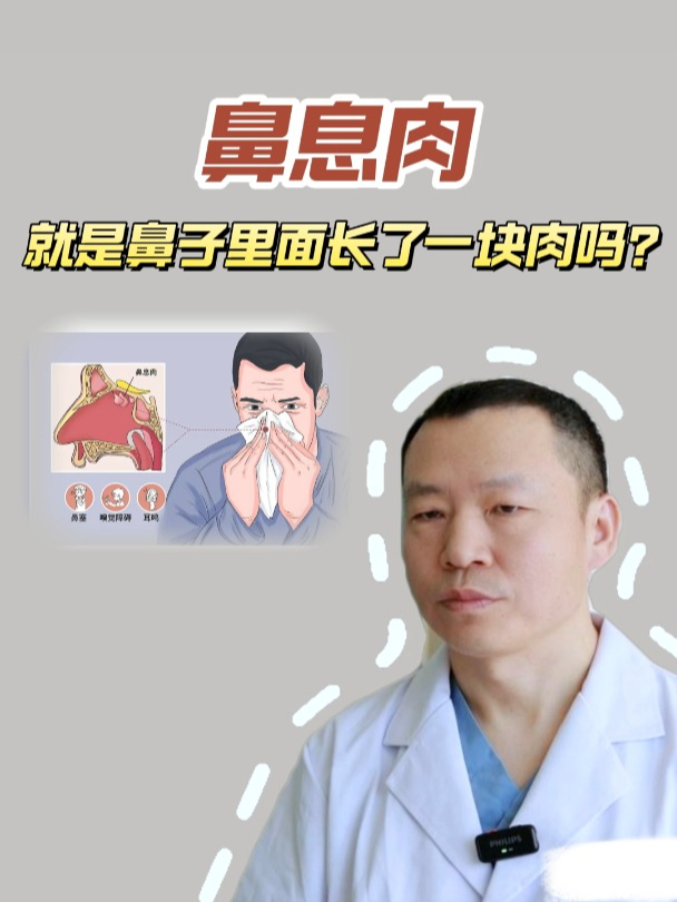 鼻息肉“长肉”?不是你想的那样!