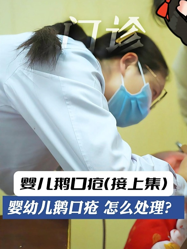 接上集!婴幼儿鹅口疮,该怎么处理?
