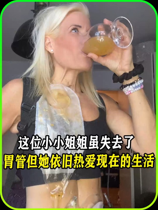 这位小姐姐虽失去了胃管,但她依旧热爱现在的生活,值得一看