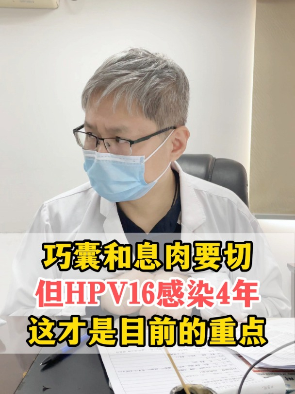 HPV16感染4年,首当其冲得做阴道镜检查,巧囊息肉往后排!