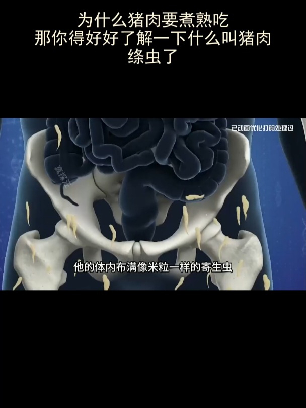 为什么猪肉要煮熟吃?那你得好好了解一下什么叫猪肉绦虫了!