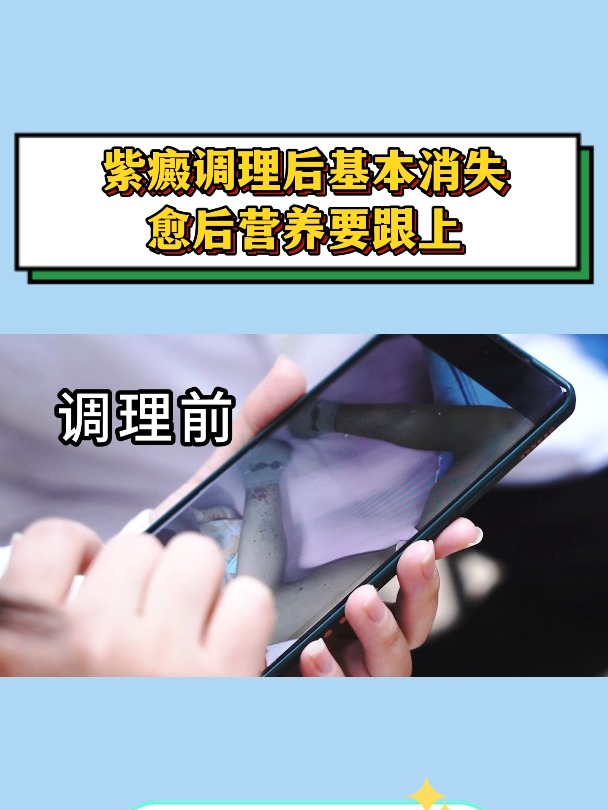 紫癜调理后基本消失愈后营养要跟上