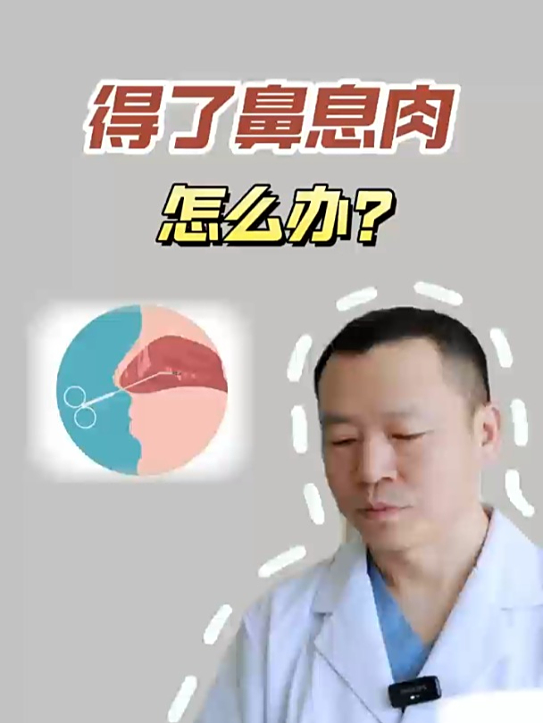 鼻息肉烦恼?快速解决你的困扰!