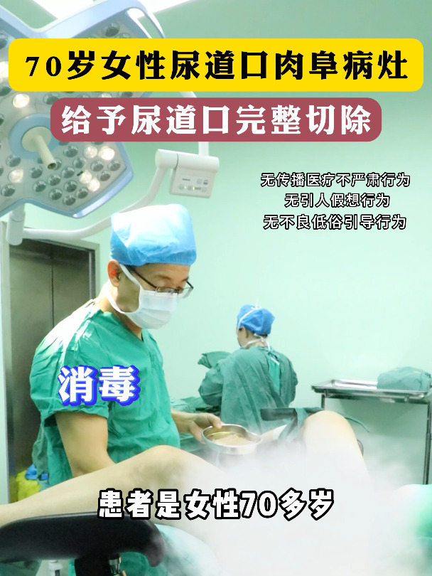 70岁女性尿道口肉阜病灶,给予尿道口完整切除