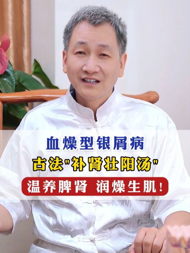 血燥型银屑病 古法“补肾壮阳汤”温养脾肾润燥生肌