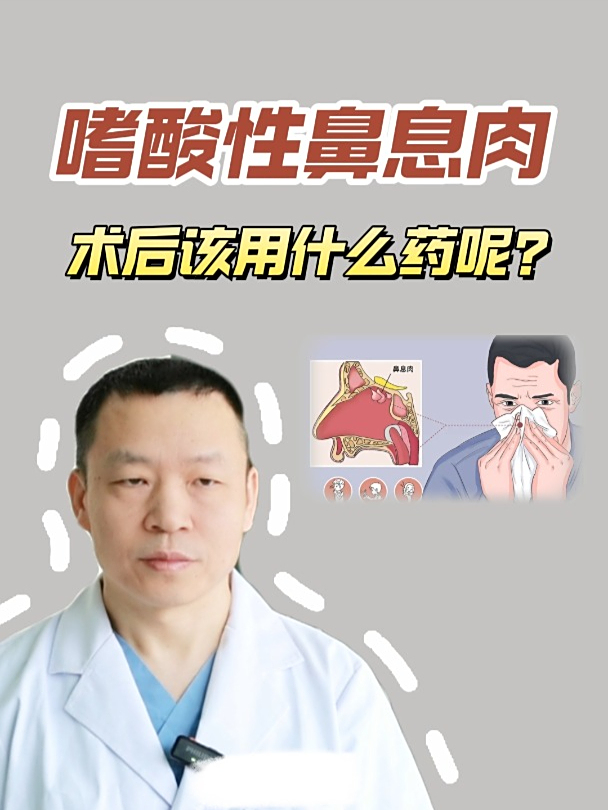 手术后药物选择,嗜酸性鼻息肉患者必看!