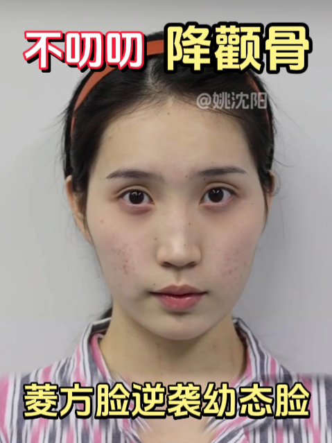 不刀刀,菱形脸变成鹅蛋脸,到底怎么做的?