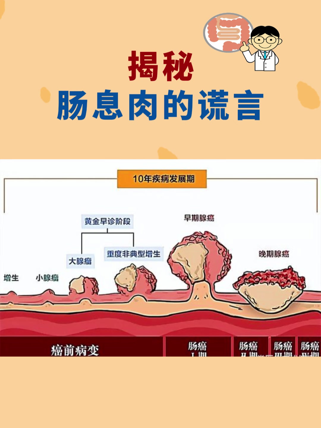肠息肉不用切?肠息肉数量越多危险越大?揭秘肠息肉的谎言