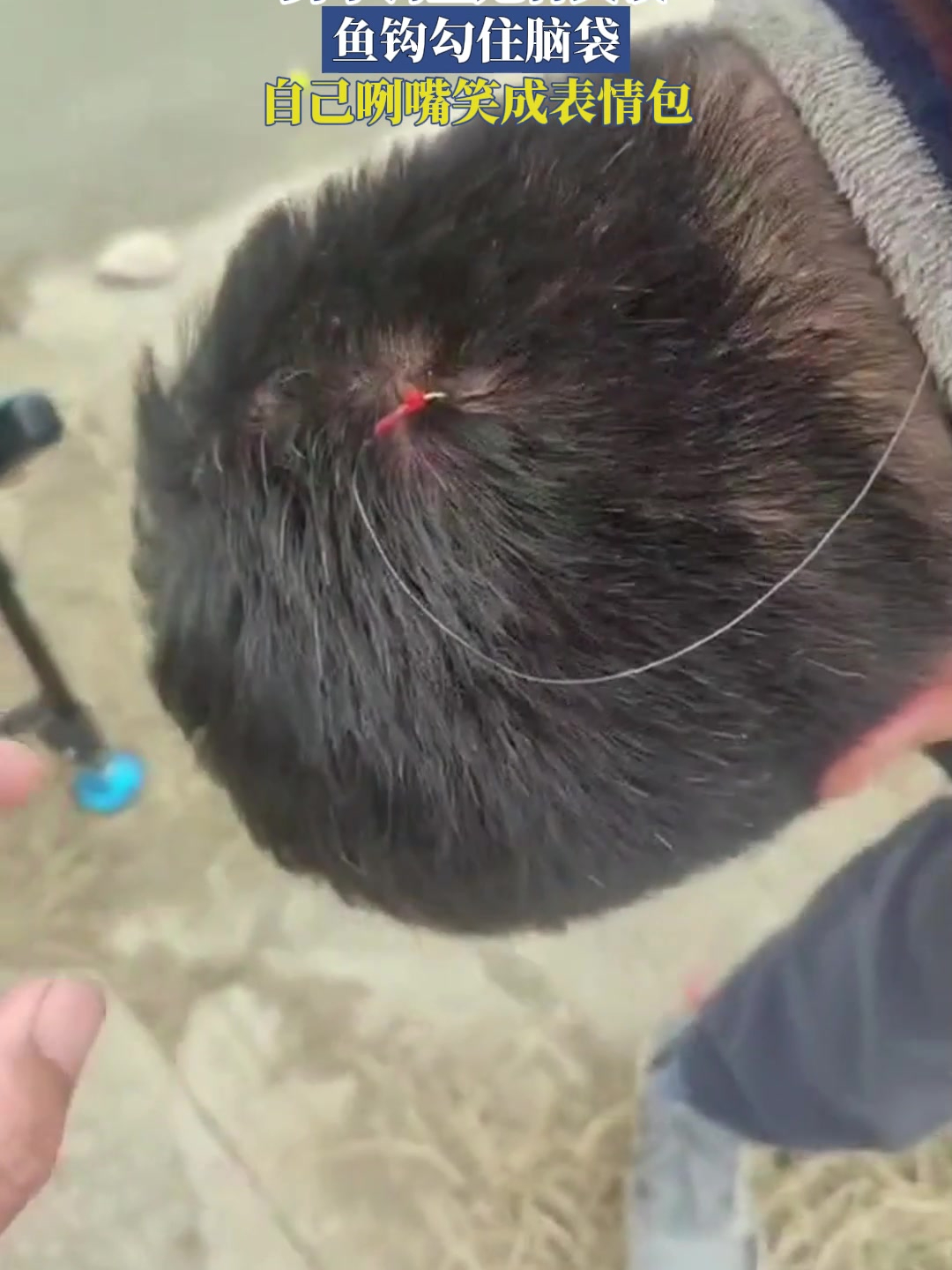 男子钓鱼甩杆失误,鱼钩勾住脑袋,自己咧嘴笑成表情包