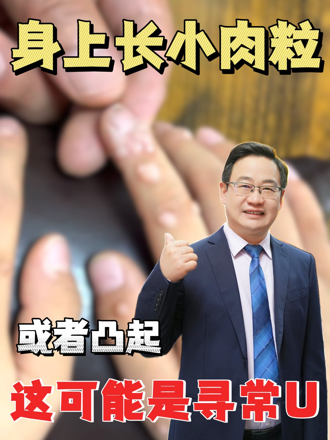 身上长出小肉粒或者凸起,这可能是寻常疣