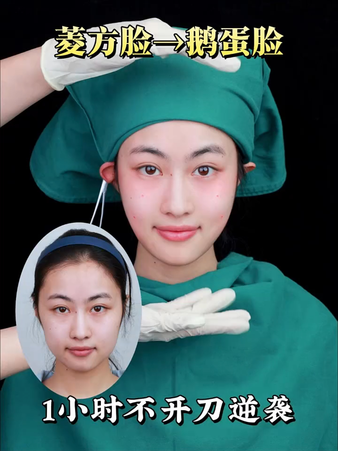 菱方脸逆袭鹅蛋脸,看看我都做了什么?