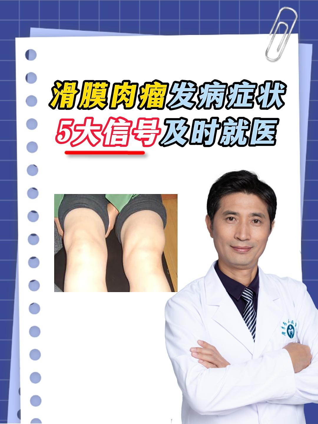 滑膜肉瘤发病症状,这5大信号及时就医
