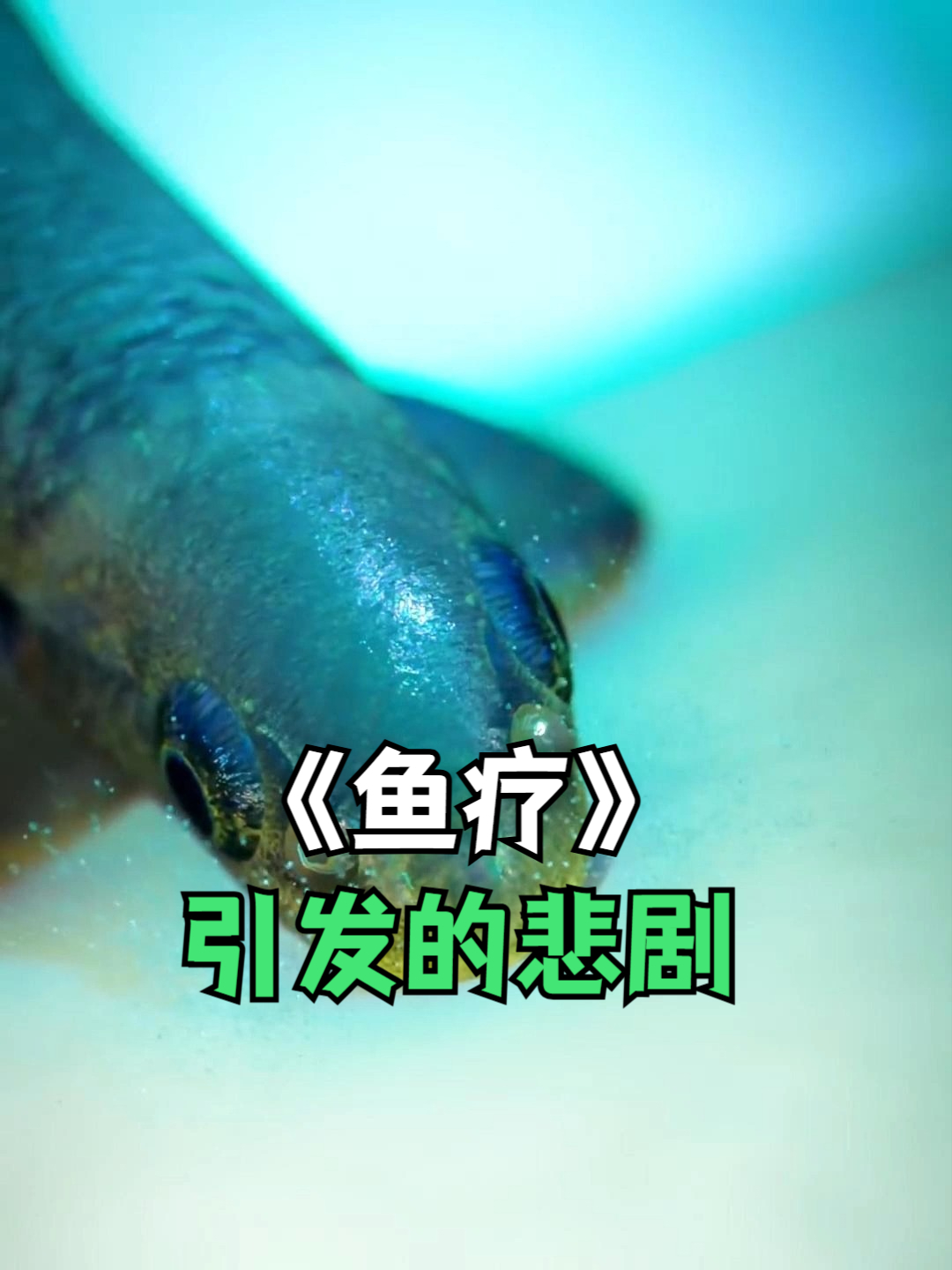 鱼疗引发的悲剧