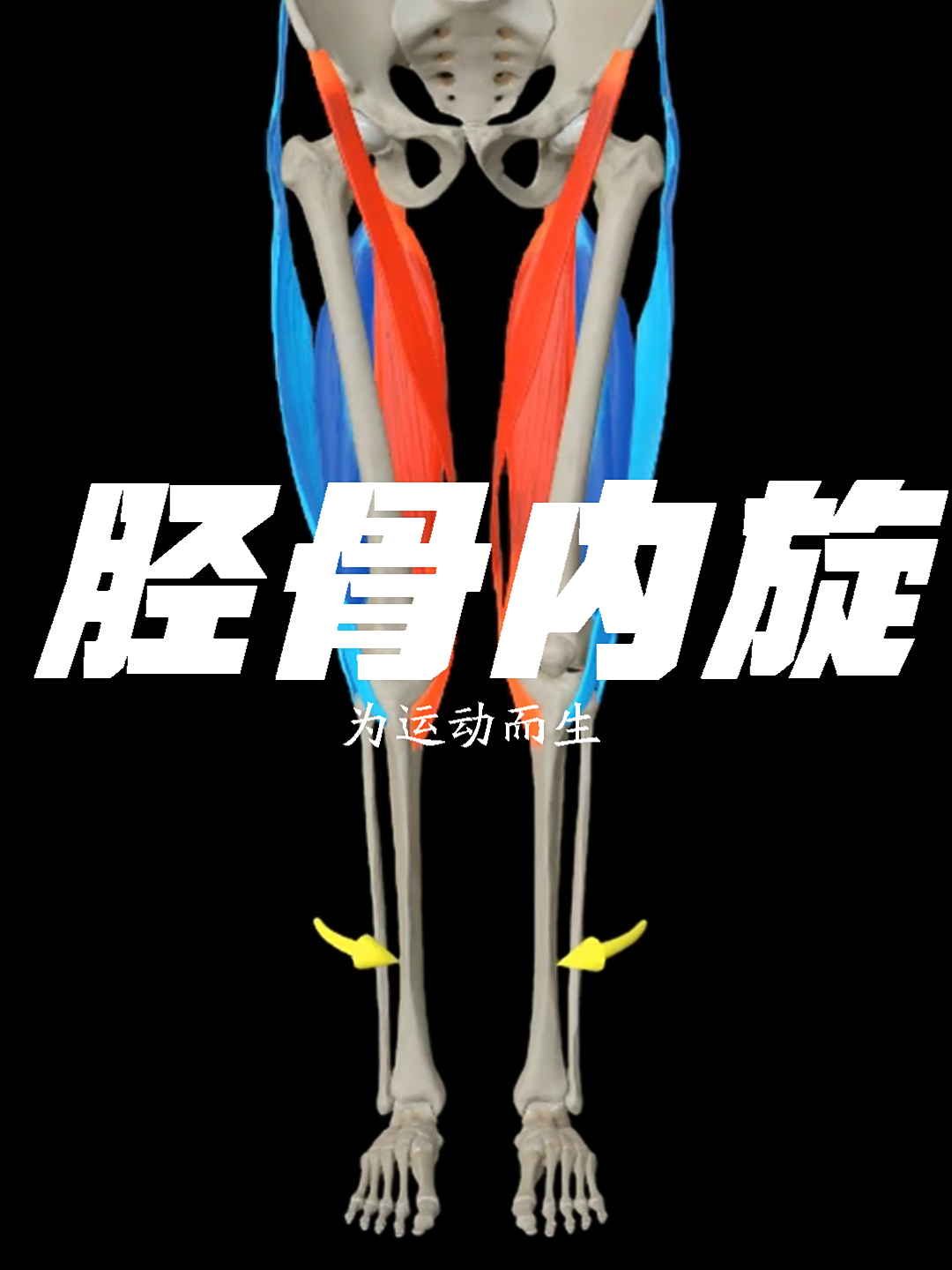 膝盖内扣+走路像鸭子？别当缺钙治！胫骨内旋是祸根！