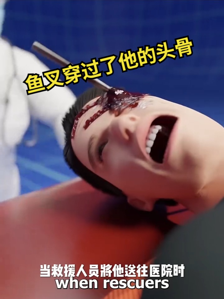 鱼叉穿过了他的头骨