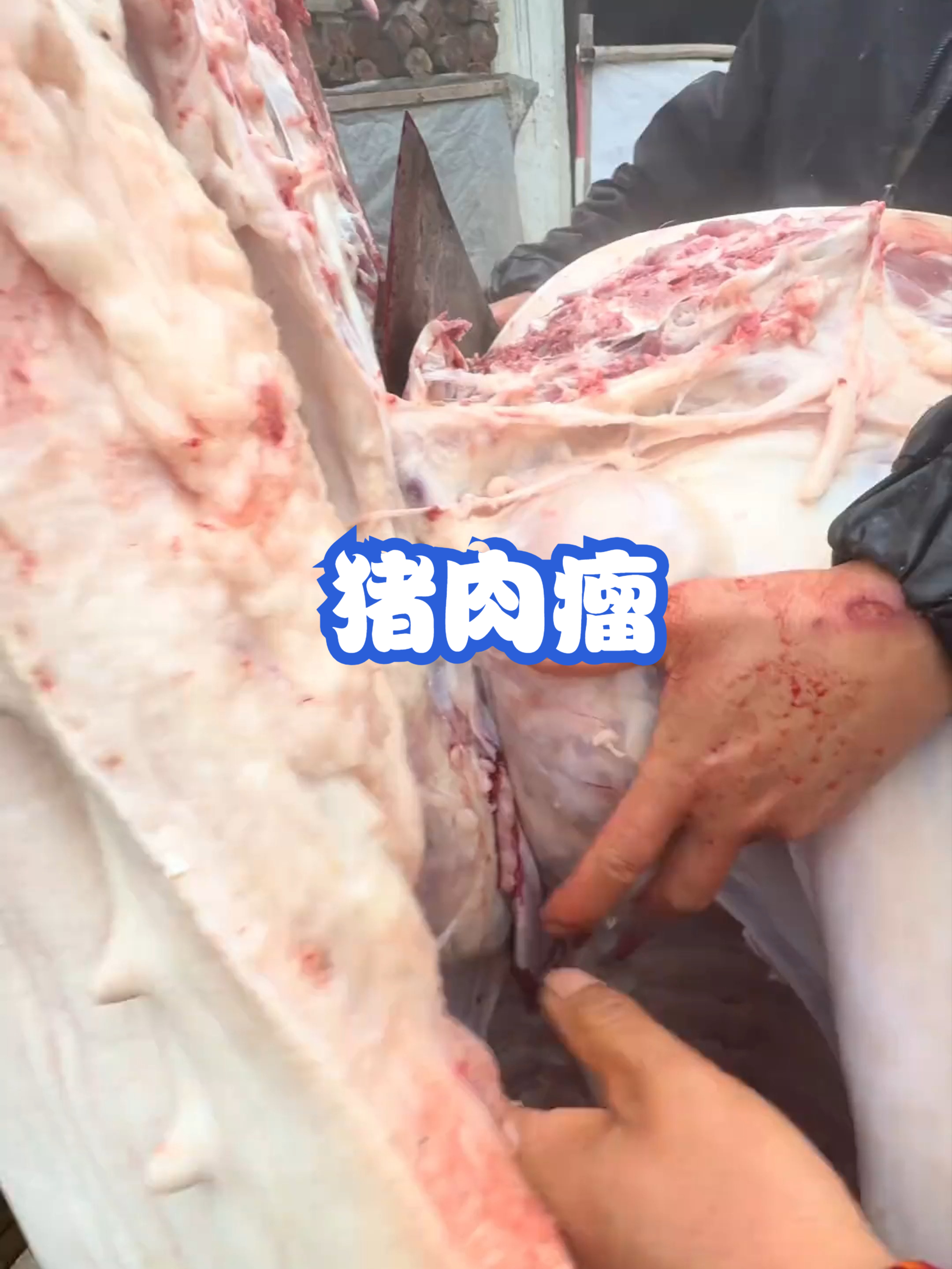 猪肉瘤