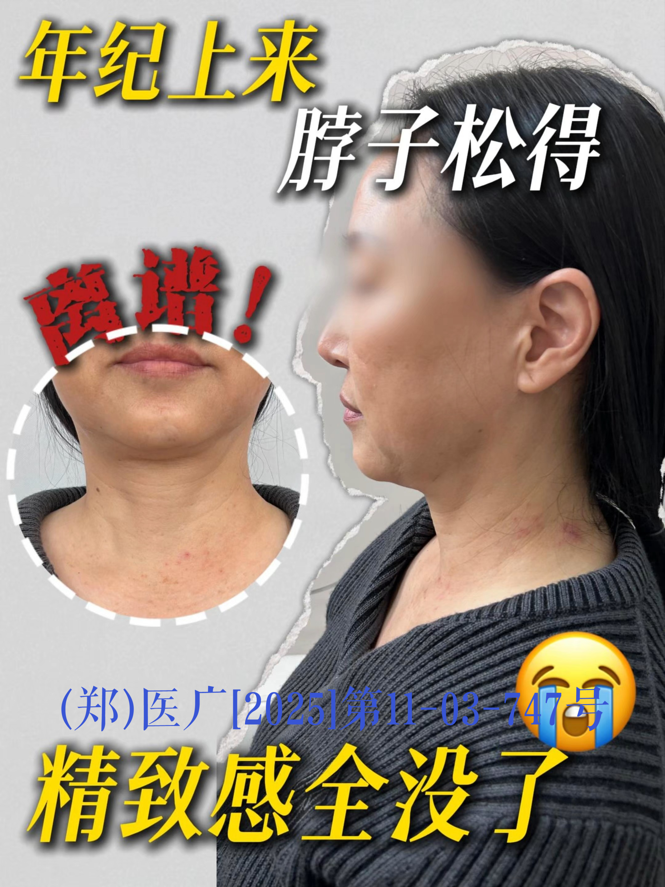 年纪上来脖子松得离谱!精致感全没了!#祛颈纹#