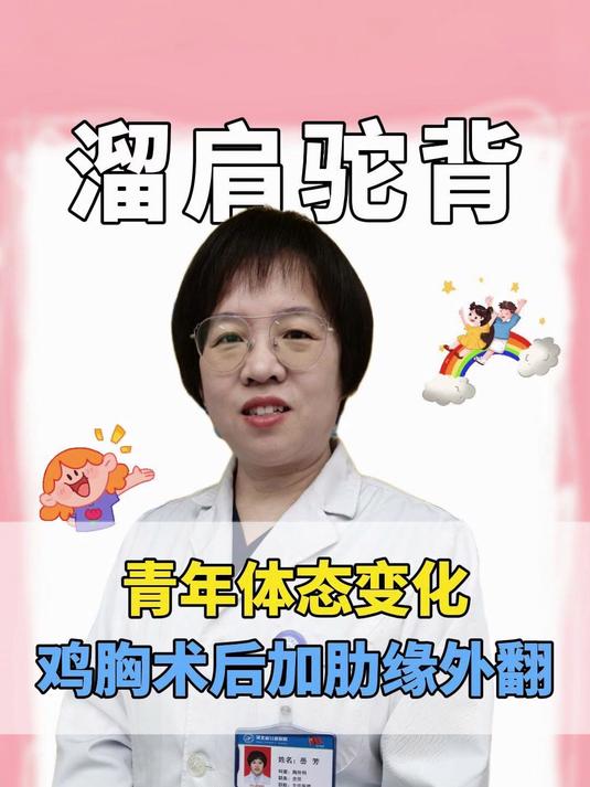 男孩鸡胸术后，前胸壁明显平了