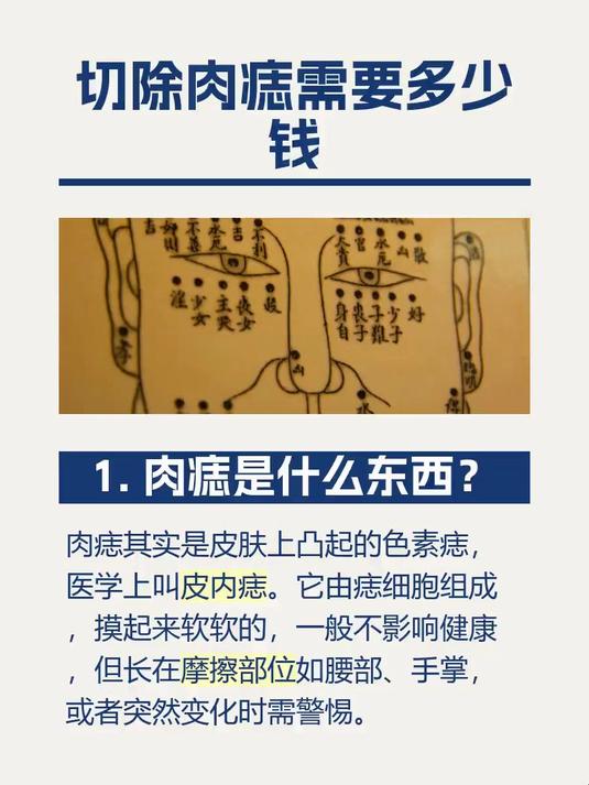 切除肉痣需要多少钱