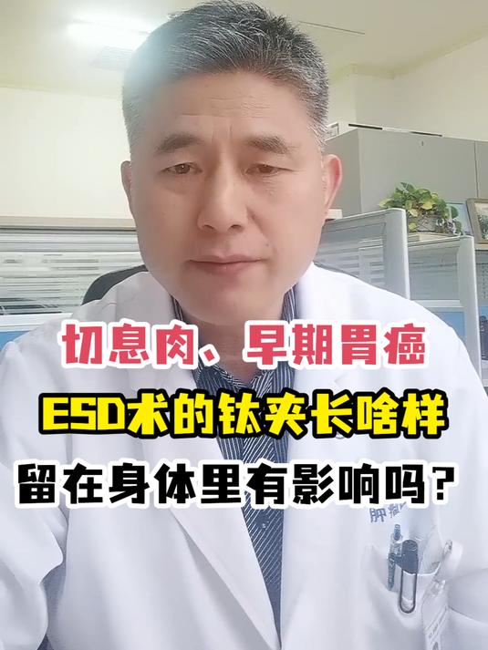 切息肉、早期胃癌ESD术的钛夹长啥样留在身体里有影响吗?
