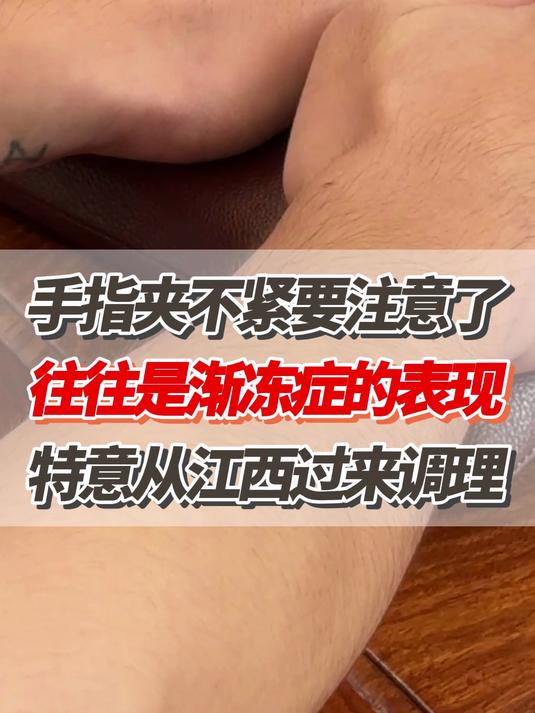 手指夹不紧要注意了、往往都是渐冻症的表现,特意从江西过来调理