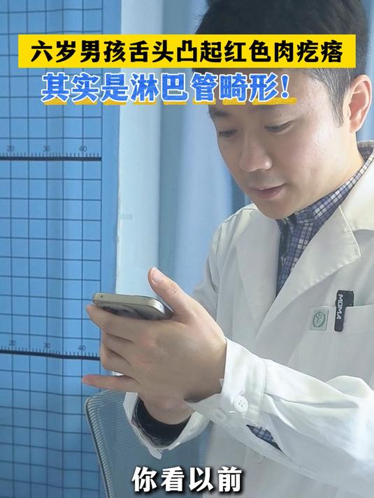 六岁男孩舌头凸起的红色肉疙瘩，其实是淋巴管畸形！