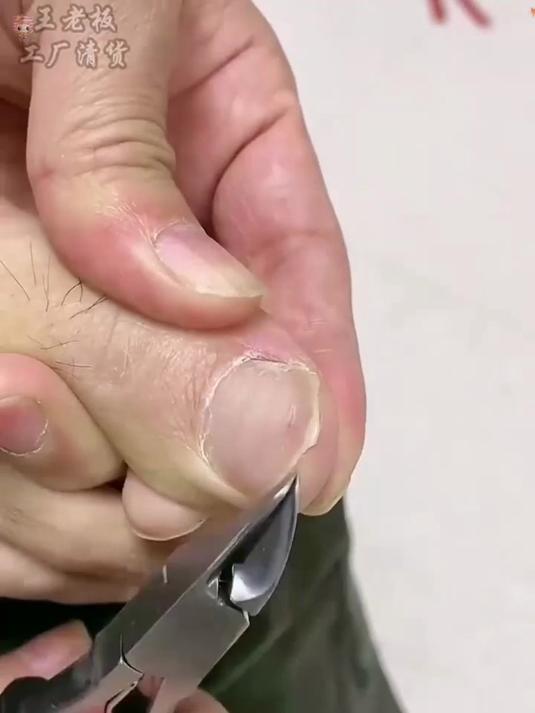指甲长肉里怎么办?试试这款鹰嘴钳,3 秒修剪断,不伤手指!