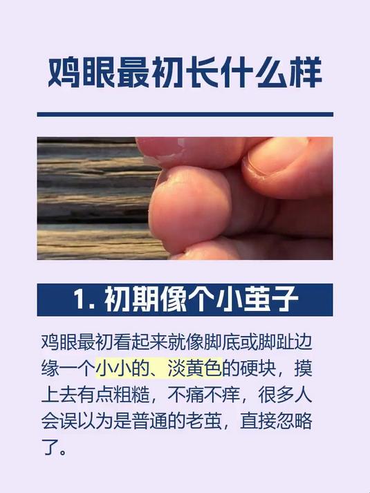 鸡眼最初长什么样