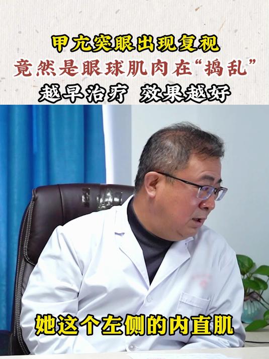 甲亢突眼出现复视,竟然是眼球肌肉在捣乱