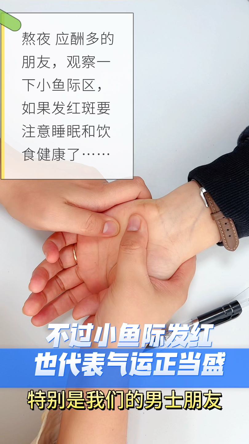 手掌外侧小鱼际检测一下你的健康运气