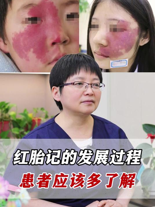 红胎记的发展过程,患者应该多了解