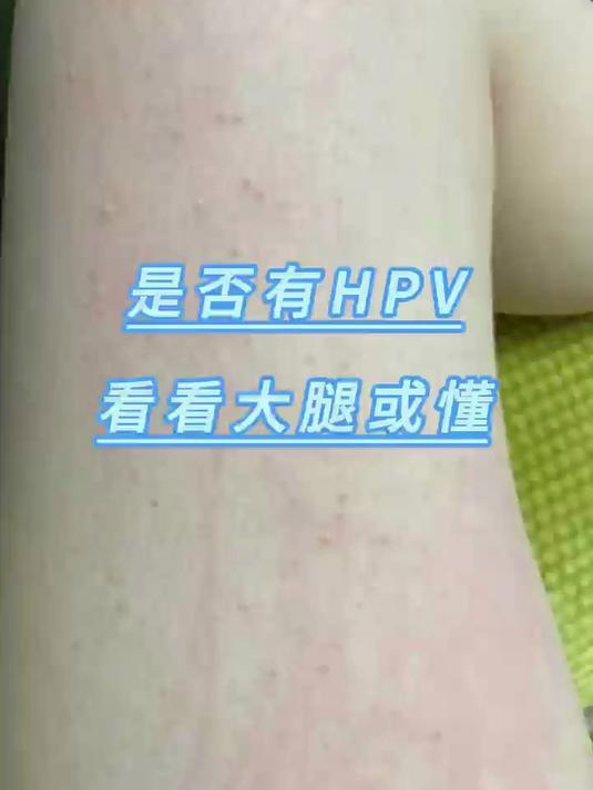 是否有HPV,看看大腿或懂