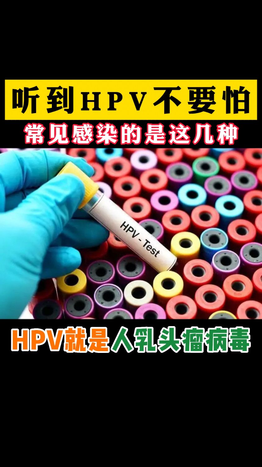 听到HPV不要怕常见感染的是这几种