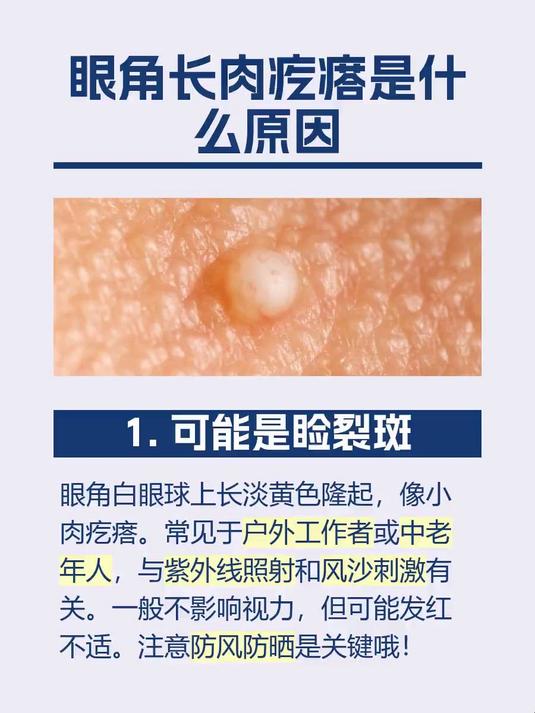 眼角长肉疙瘩是什么原因