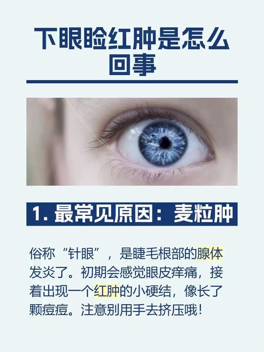 #马上健康过大年#下眼睑红肿是怎么回事