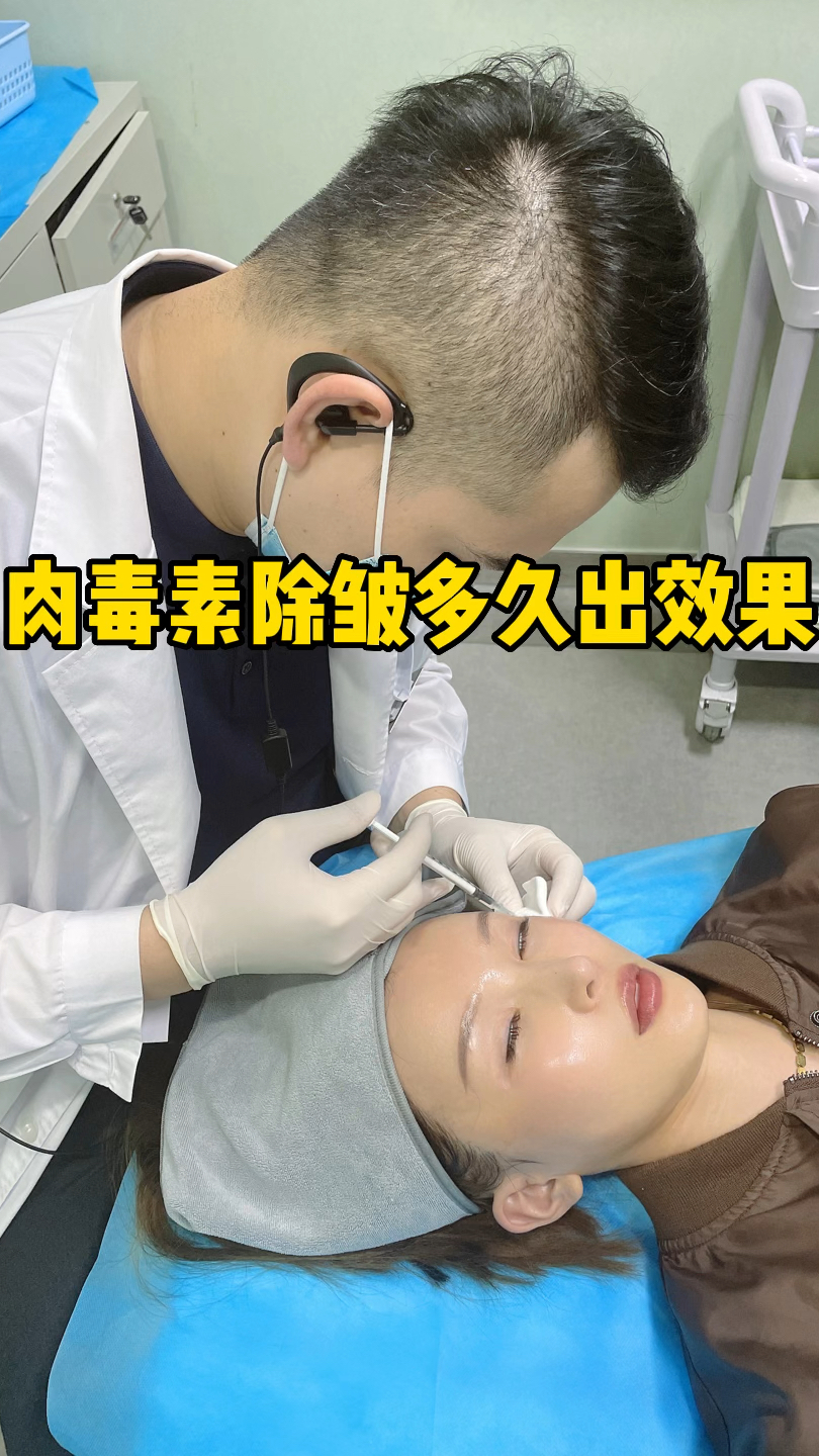 肉毒素除皱多久出效果