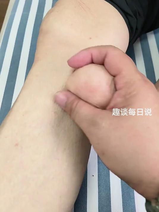 男子身上竟长出鸡蛋瘤子,网友:刚刚没看清楚我还以为是鸡蛋