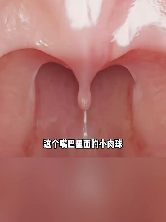 口腔里的小球叫什么名字 #悬雍垂 #涨知识 #口腔