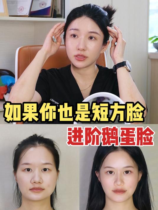 短方脸|又是哪个小女孩变成鹅蛋脸美女了?
