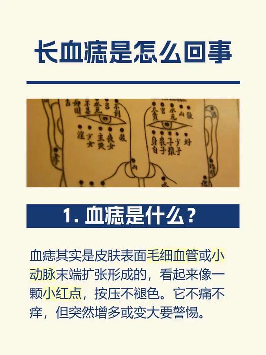 长血痣是怎么回事