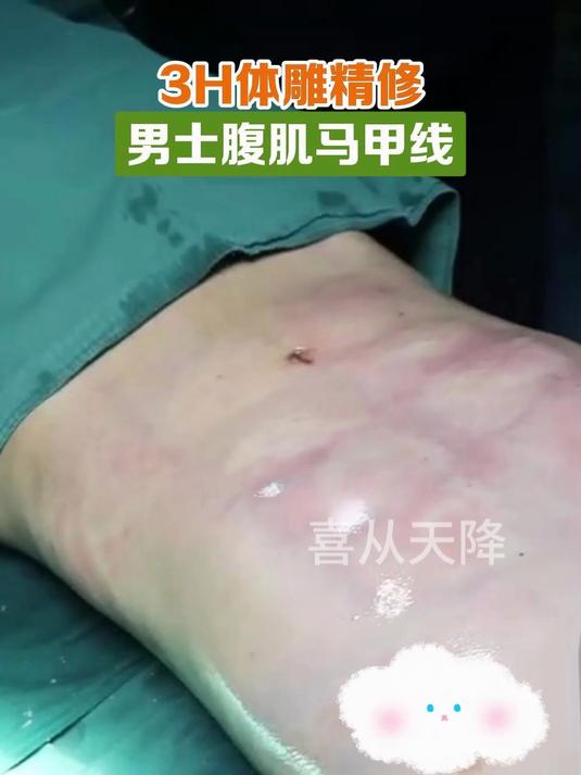 3H体雕精修,男士腹肌马甲线