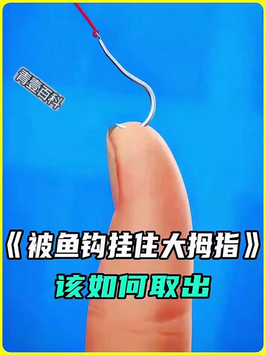 被鱼钩勾住该如何取出？